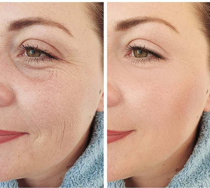 Microneedling Infusion kit: The Anti-Aging Solution